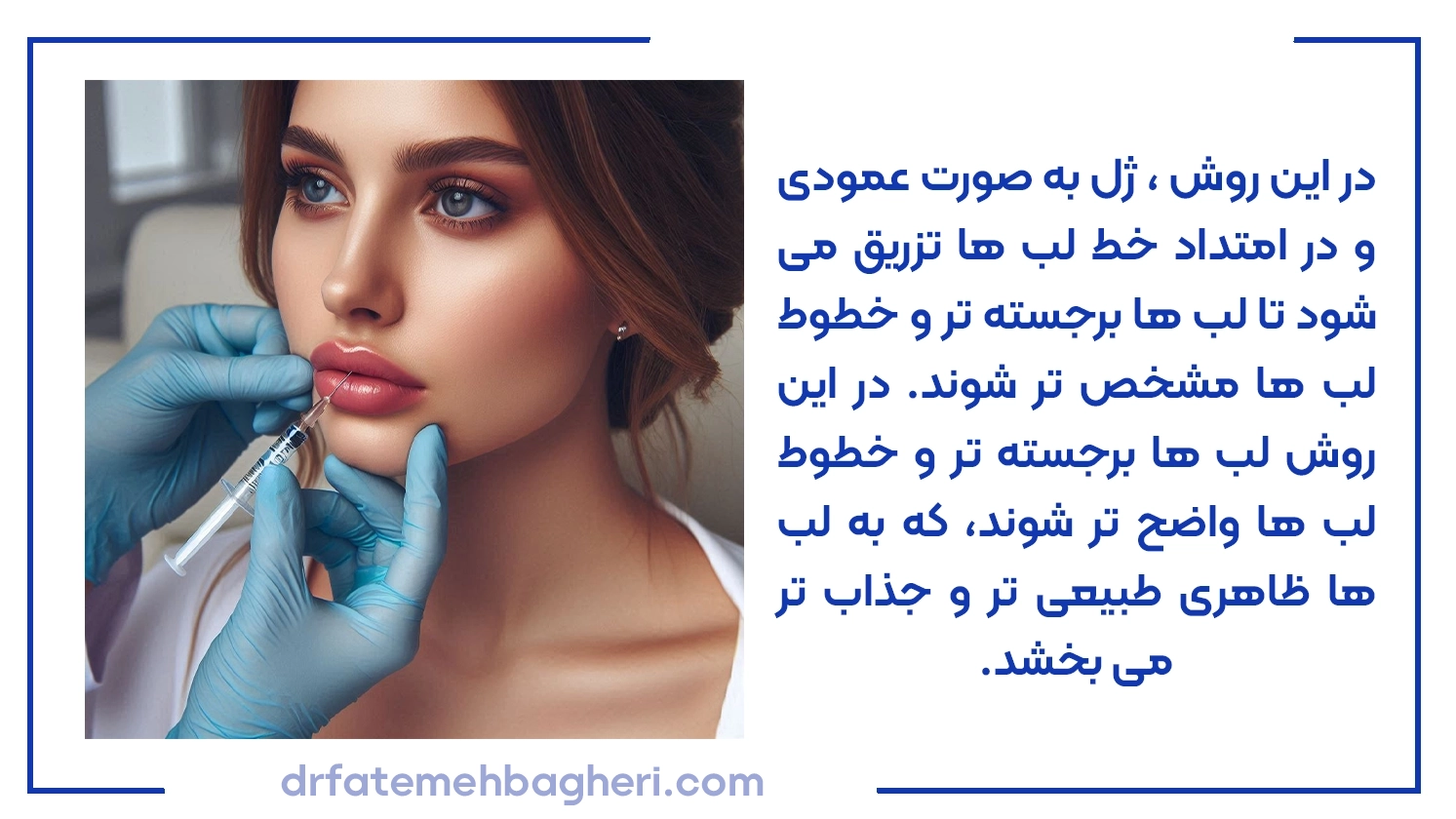 ژل لب روسی خط دار