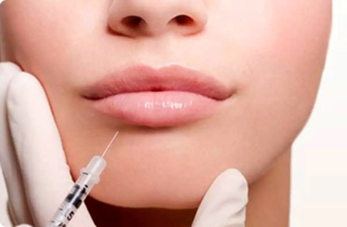 اشتباهات رایج در تزریق فیلر و راه‌های جلوگیری