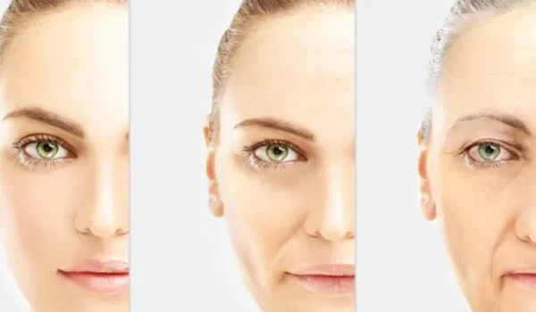بهترین سن برای شروع بوتاکس چه زمانی است؟